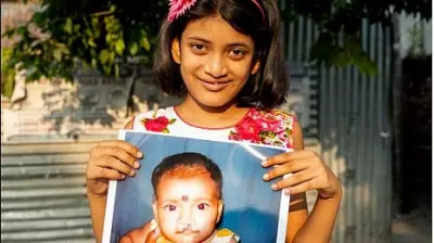 90% Feel More Socially Accepted After Cleft Surgeries, Study Finds