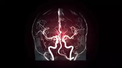 Cerebral Angiography: Vital Test for Brain Vascular Health