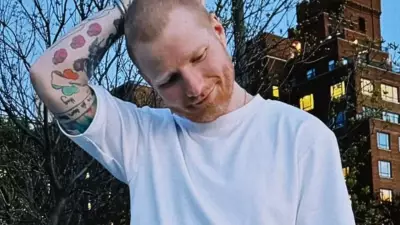 Ed Sheeran Reveals Shingles Diagnosis at Age 35: What You Need to Know