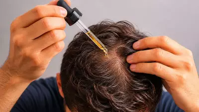 Finasteride and Minoxidil for Hair Loss: Can They Trigger Depression or Anxiety? Dermatologist Explains