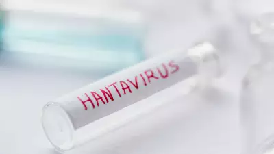 Hantavirus vs Covid-19: Why This Rare Infection Is Not a Human-to-Human Threat