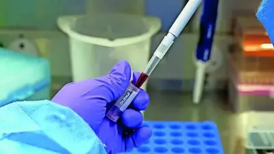 India Steps Up Ebola Screening as Suspected Cases Test Negative