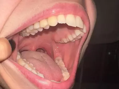 Japanese Scientists Begin Human Trials for Tooth Regrowth Drug TRG-035