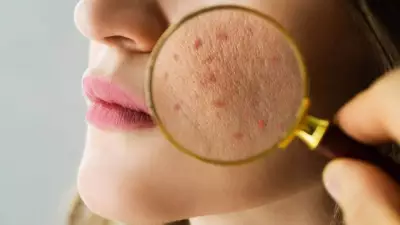 Laser Treatments for Seasonal Pigmentation: Expert Guide to Dark Spots and Uneven Tone