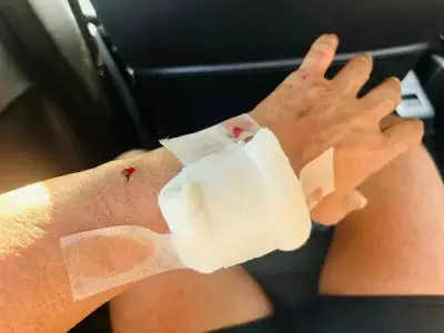 Marathon Runner Injured in Stray Dog Attack During Training