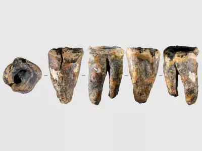 Neanderthals Performed Advanced Dental Surgery 60,000 Years Ago