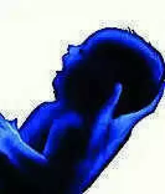 Pune PMC Sends Notice to Hospital Over Newborn Death After C-Section