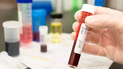 Singapore Recommends Lifetime HIV Test for All Adults