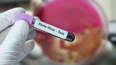 Ugandan Woman in Bengaluru Tests Negative for Ebola After Isolation