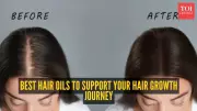 5 Best Hair Oils for Hair Growth: Coconut, Rosemary, Castor, Bhringraj, Almond