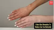 5 Desi Home Remedies to Remove Stubborn Tan Fast This Summer