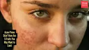 5 Fruits That Could Be Triggering Your Acne Breakouts
