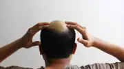 7 Natural Supplements That Could Help Slow Hair Loss: Expert Insights