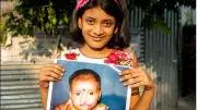 90% Feel More Socially Accepted After Cleft Surgeries, Study Finds