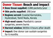 Allografts Gain Popularity Among Mangaluru Surgeons for Complex Surgeries