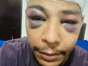 Bihar Youth Allegedly Assaulted in Gurugram Over Language Dispute