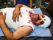 BJP Worker Attacked During Punjab MC Elections in Abohar