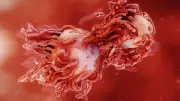 Cancer Doesn't Always Hurt: Why Pain-Free Symptoms Need Attention