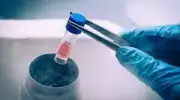 Chennai Woman Gets Life-Saving Bone Marrow Transplant from Polish Donor