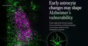 Early Alzheimer's Marker Found in Female Mice Study
