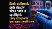 Ebola Outbreak: Early Symptoms Everyone Should Know About the Deadly Virus