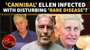 Ellen DeGeneres Kuru Disease Rumors Debunked: No Evidence