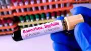 Gonorrhea and Syphilis Cases Reach Record High in Europe, ECDC Reports