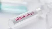 Hantavirus: Early Symptoms Deceptive, Can Cause Rapid Organ Failure, Doctors Warn