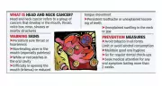 Head and Neck Cancers Rising Among Young Non-Smokers in Bengaluru