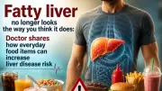 Hidden Sugar Is Silently Damaging Your Liver: What You Need to Know
