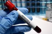 Himachal Deploys Health Teams Across Shimla Amid Hepatitis C Surge