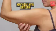 How to Manage Loose Skin After Rapid Weight Loss: Expert Tips