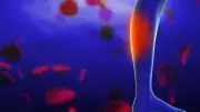 Leg Cramps: When to See a Doctor for Relief and Treatment