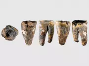 Neanderthals Performed Advanced Dental Surgery 60,000 Years Ago