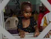 Odisha Child Wasting Rises to 22.1%, Above National Average: NFHS-6
