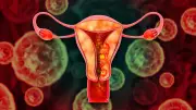 Period Blood Test May Detect Endometriosis, Say Researchers