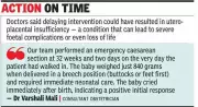 Silent High-Risk Pregnancy: Emergency C-Section at 32 Weeks Saves Mother and Baby