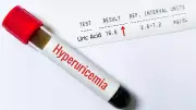 Silent Uric Acid Crisis: 1 in 4 Indians at Risk