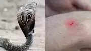 Snakebite Cases Surge Across India as Summer and Monsoon Drive Encounters