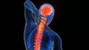 Spinal Cord Injury Delayed Treatment Overcomes Paralysis Through Surgery and Rehab
