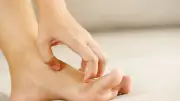Summer Fungal Infections: Prevention Tips and Risks of Steroid Creams
