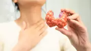 Thyroid Disease in India: No Longer Just a Middle-Aged Women's Issue