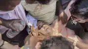TMC MP Kalyan Banerjee Alleges Attack by BJP Workers in West Bengal