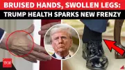 Trump Health Report: Bruising and Leg Swelling Addressed in White House Update