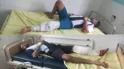 Two Robbery Suspects Injured in Gurgaon Police Encounter