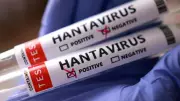 Two US Citizens Show Mild Hantavirus Symptoms on Evacuation Flight