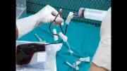 UK Cancer Nurses Exposed to Hazardous Drugs, Risking Miscarriage and Infertility