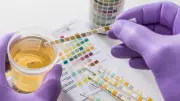 Urine Color: What Your Body Is Trying to Tell You About Your Health