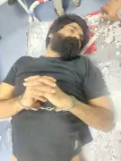 Wanted Criminal Shot in Foot During Police Operation in Ahmedabad
