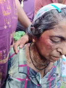 Woman Seriously Injured in Wild Elephant Attack in Madikeri